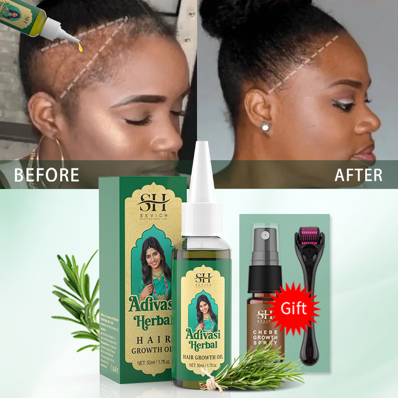 Ayurvedic Hair Growth Oil Indi - Beard Oil Growth 评论和价格