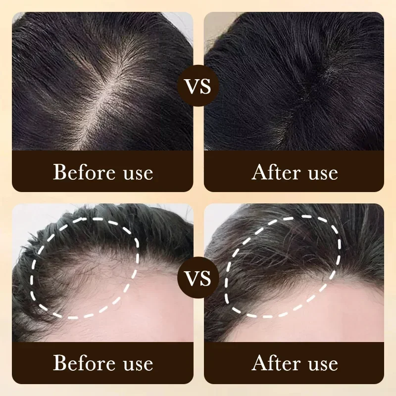 Biotin Fast Hair Growth Oil Pr - Beard Oil Growth 评论和价格