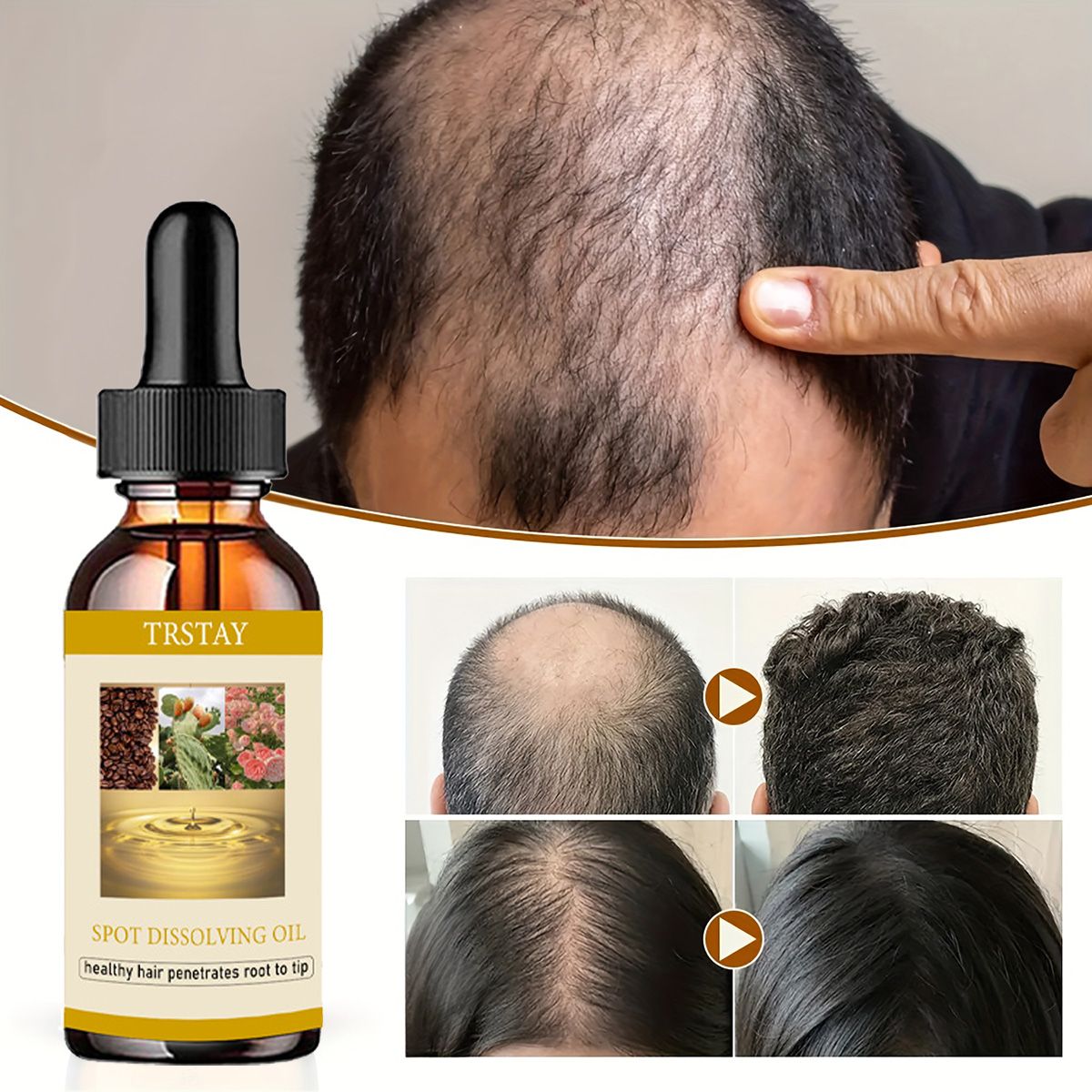 50ML Beard Growth Oil Anti Alo - Beard Oil Growth 评论和价格