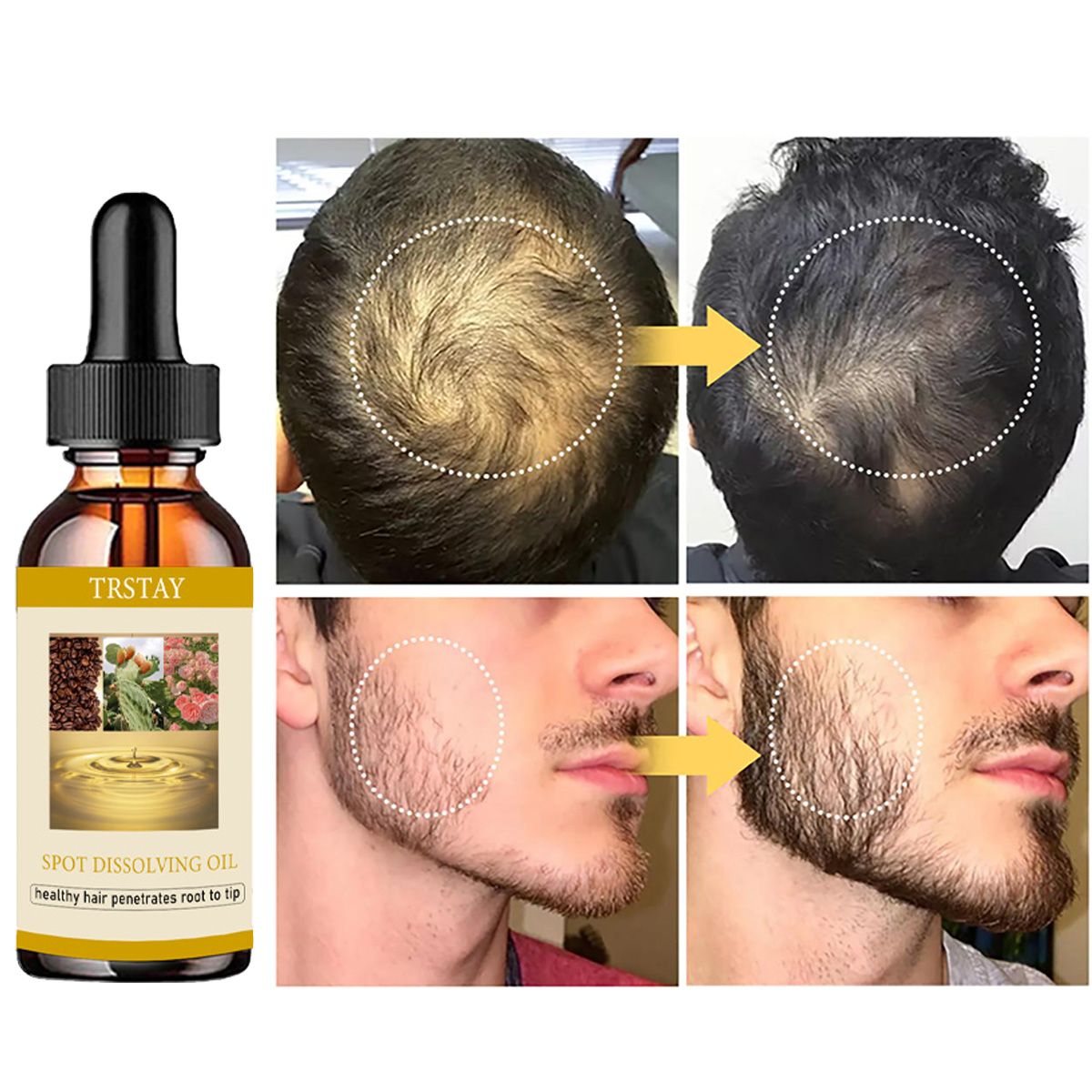 50ML Beard Growth Oil Anti Alo - Beard Oil Growth 评论和价格