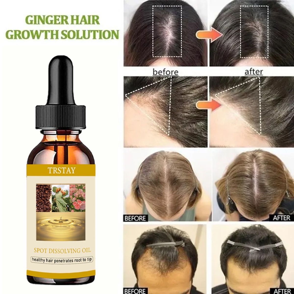 50ML Beard Growth Oil Anti Alo - Beard Oil Growth 评论和价格