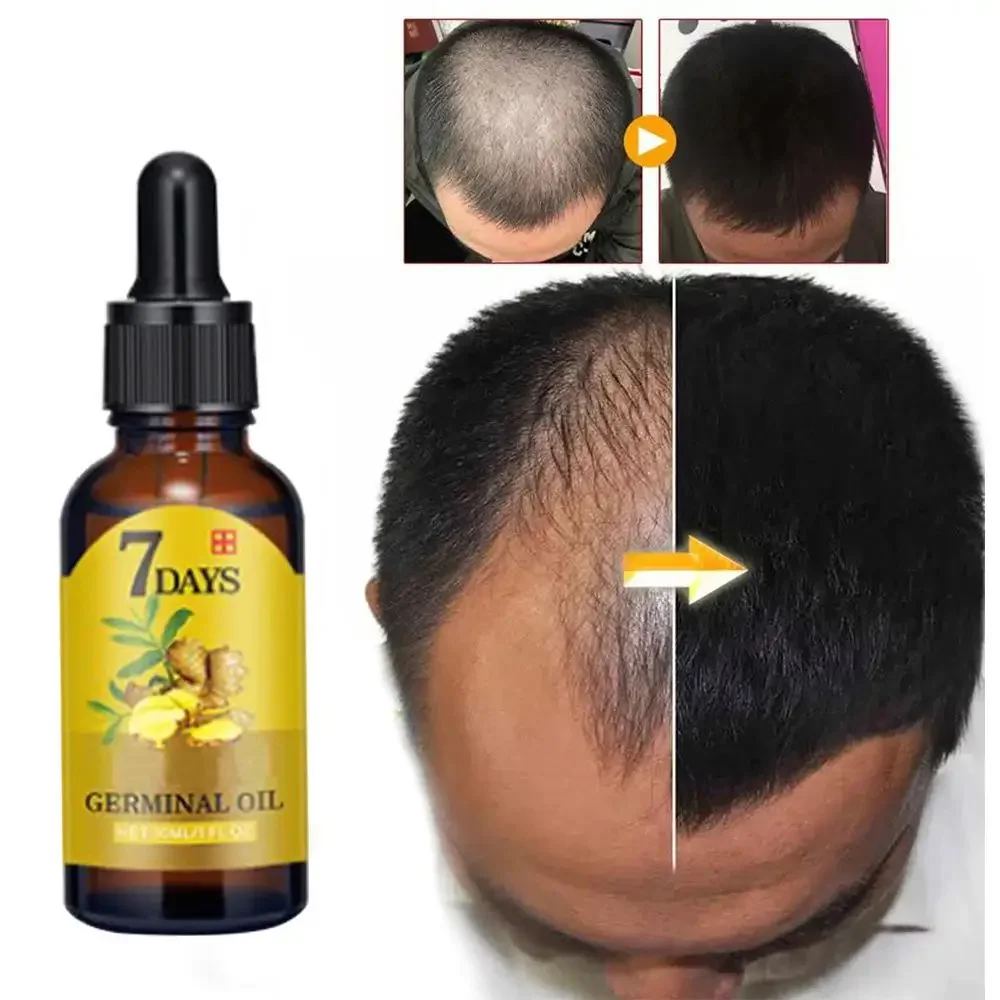 Hair Growth Ginger Fast Growin - Beard Oil Growth 评论和价格