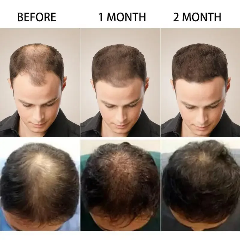 Hair Growth Ginger Fast Growin - Beard Oil Growth 评论和价格
