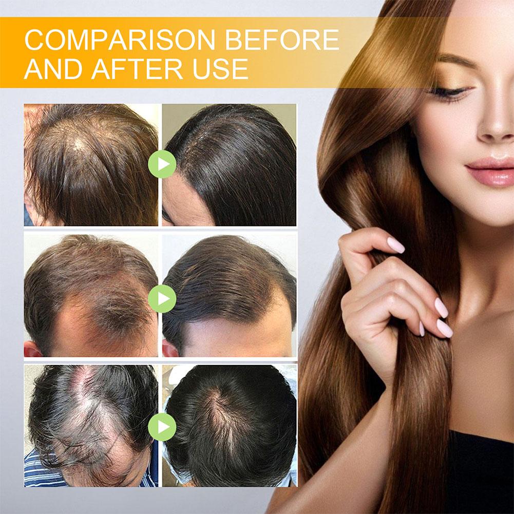 5/3/1pcs Biotin Fast Hair Grow - Beard Oil Growth 评论和价格